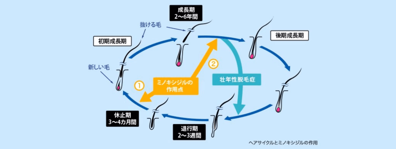 有効成分ミノキシジル