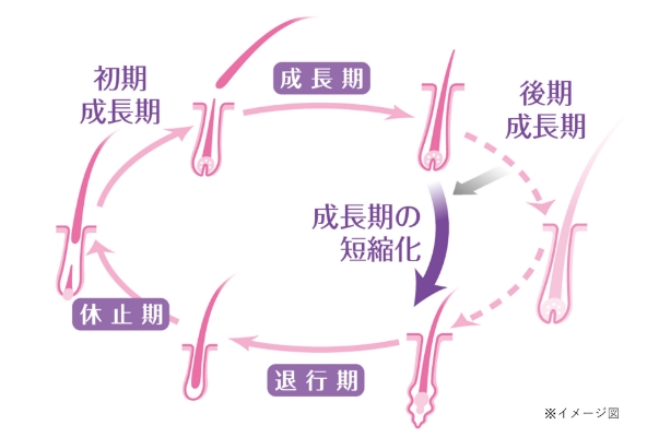 壮年性脱毛症のヘアサイクルの図