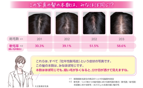 4枚の分け目の写真は、総毛数がほぼ同じだが、軟毛率が30.3％、39.1％、51.5％、58.6％となっており、細い毛が多くなるほど、分け目が透けて見える。